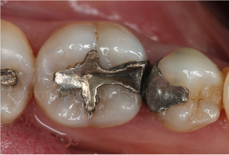 old restoration.