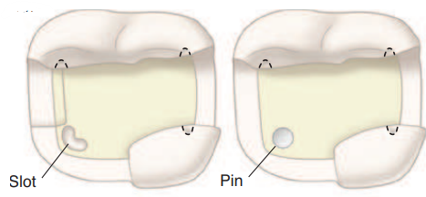 Slots in cavity preparation.