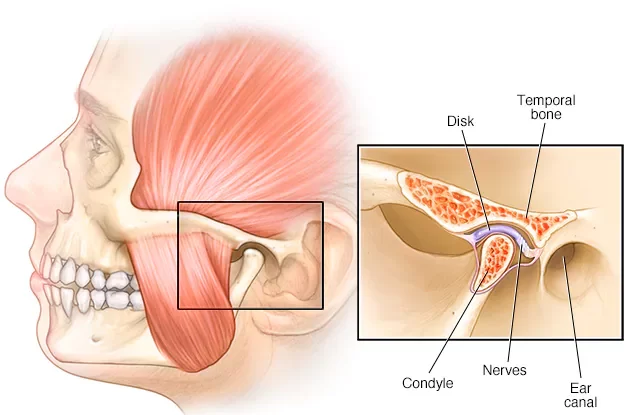 TMJ disorders in single visit endodontics.